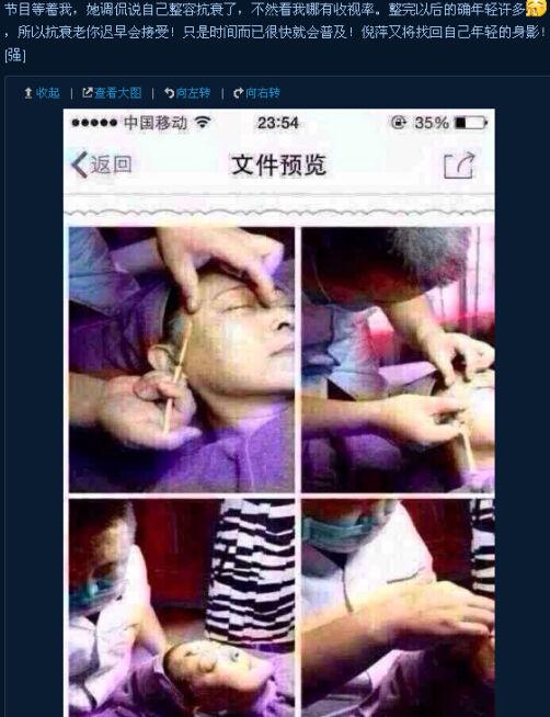 倪萍老练回春疑整容过程曝光 动刀填平额头眼角皱纹